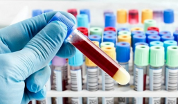 Hà Nội giải thích vụ test nhanh Covid-19 âm tính, xét nghiệm lại dương tính