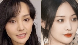 'Tượng đài thanh xuân' Trịnh Sảng gây choáng với nhan sắc tiều tụy khó nhận ra