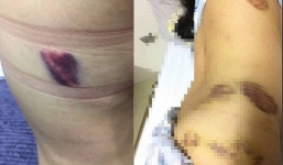 Cán bộ sở GD&ĐT Thanh Hóa trần tình việc bị tố bắt vợ sắp cưới cởi đồ chụp ảnh đăng FB vì ghen