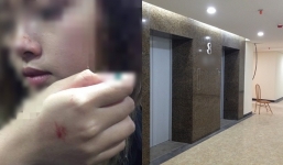 Giám đốc Công an Hà Nội lên tiếng vụ nữ sinh bị 'yêu râu xanh' sàm sỡ trong thang máy