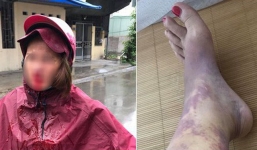 Mót rau nuôi chồng thuở hàn vi, khi thành đại gia thì chồng cặp bồ, đánh vợ