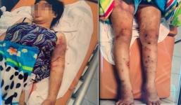 Thai phụ bị giam cầm 20 ngày, tra tấn đến sẩy thai kể lại những giây phút kinh hoàng