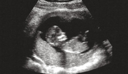 Em bé nhảy nhót trong bụng mẹ khiến người xem chia sẻ không ngớt