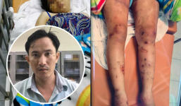 Khởi tố 1 kẻ chủ mưu giam cầm, tra tấn khiến thai phụ 18 tuổi mất con