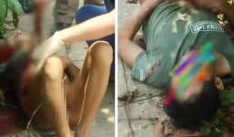 'Ma men' tự cầm dao rạch bụng nghi do say rượu