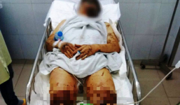 Vụ Việt kiều bị tạt axit, cắt gân chân: Hé lộ chân dung 2 nghi can