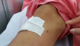 Bộ Y tế yêu cầu xác minh vụ 'gãy đốt sống ngực, khoan nhầm cẳng chân'