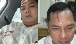 Vụ giang hồ vây xe công an ở Đồng Nai: Người bị đánh rách trán nói gì?
