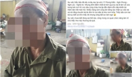 Xác minh thông tin con dâu ngược đãi mẹ chồng, đánh bầm tím mặt mày ở Nghệ An