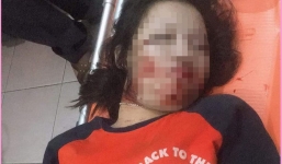 Xe tải đâm trúng đường dây điện khiến nữ sinh 17 tuổi tử vong thương tâm