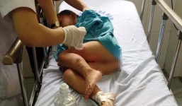 Thông tin mới vụ 3 trẻ bị bỏng nhập viện khi học kỹ năng phòng cháy