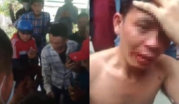 Công an vào cuộc vụ ông bố bị nhóm người xăm trổ đánh vì clip bạo hành con trai