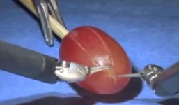 Robot phẫu thuật Vinci gây kinh ngạc khi lột vỏ một quả nho