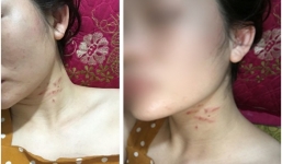 Điều tra thông tin mẹ trẻ và 3 con nhỏ bị bạo hành suốt 7,8 năm