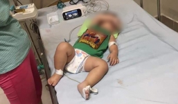 Vụ 3 chị em ruột ở Sóc Sơn tử vong vì mắc Whitmore: Sở Y tế Hà Nội lên tiếng