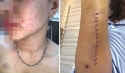 Chồng bạo hành vợ như quân thù trong đêm Noel khiến dư luận phẫn nộ