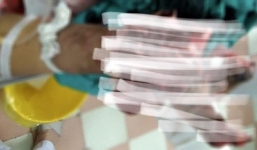 Thêm nam sinh dập nát cẳng bàn tay phải vì học làm pháo trên mạng