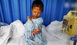 Ăn cơm với ớt suốt 5 năm, cô sinh viên nghèo nặng 21kg tử vong 