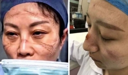 Kiệt quệ trên tuyến đầu chống dịch Corona, 2 y tá từ Vũ Hán cầu cứu đồng nghiệp