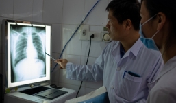 Việt Nam không tham vấn bác sĩ Rafi Kot trong quá trình phòng chống dịch Covid-19