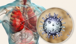 Tác động của Covid-19 giống như một sự kết hợp giữa SARS và AIDS