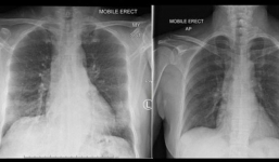 Phát hiện tế bào hệ miễn dịch của con người 'chống trả' lại Covid-19