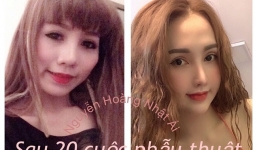 Bị người yêu chia tay vì quá xấu, 9X 'đập đi xây lại' thành búp bê sống