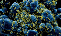 Phát hiện mới về độ tổn thương của SARS-CoV-2 gây ra cho bệnh nhân