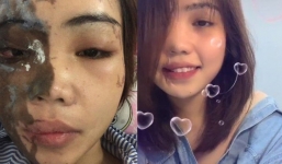 Cô gái xinh đẹp bị chồng sắp cưới tạt axit đã trở lại với nụ cười rạng rỡ