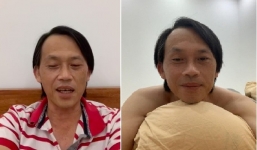 Hoài Linh lộ vẻ già nua, tiều tuỵ khi livestream giao lưu với khán giả 