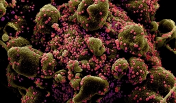 Phát hiện kháng thể ngăn sự lây nhiễm SARS-CoV-2 từ tế bào nuôi cấy