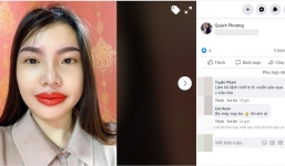 Khoe trùng tu lại nhan sắc, Phượng 'Thị Nở' bị chê nhìn như ong đốt