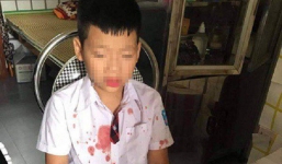 Vụ bé trai lớp 1 bị bố của bạn hành hung: 'Chồng tôi đánh trẻ con là sai, nhưng cái gì cũng phải rõ trắng đen'