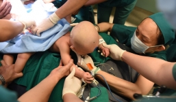 Tâm nguyện xúc động của giám đốc BV Nhi đồng trước cuộc đại phẫu cho cặp song sinh dính liền