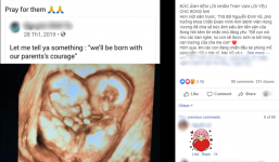 Bức ảnh siêu âm cặp 'song Nhi' và lời nhắn nhủ của bác sĩ 1 năm gây xúc động