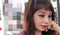 Cô dâu Cao Bằng mặt vẫn lệch vẹo sau 3 tuần dao kéo ngay cả khi dùng app chỉnh ảnh