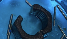 Thử cảm giác mạnh với ốc vít, thanh niên suýt mất 'của quý'