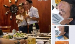 Chủ tịch huyện bị 'tố' hát karaoke ôm, đánh nhau 'bể đầu sứt trán'