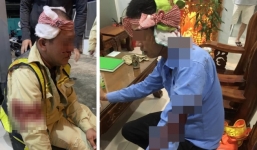 Nhân viên, bảo vệ Trạm thu phí BOT bị côn đồ đánh trọng thương