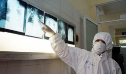 Ca mắc Covid-19 đầu tiên trong đợt dịch mới tiên lượng nặng hơn nam phi công người Anh