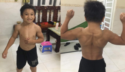 Cậu bé 10 tuổi ở Đồng Nai mắc hội chứng hiếm gặp khiến cơ bắp cuồn cuộn như lực sĩ 