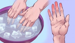 Chỉ cần ngâm tay vào chậu nước đá 30 giây, bạn sẽ biết mình có bị 'sát thủ thầm lặng' ghé thăm