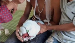 Laptop phát nổ khi cắm sạc khiến 3 học sinh lớp 9 bị thương phải nhập viện