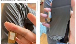 Tin công nghệ ngày 27/10: iFans phàn nàn tình trạng tay bị tấy đỏ, đứt tay khi cầm iPhone 12