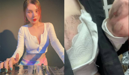 Nữ DJ xinh đẹp bị kẻ giật điện thoại kéo lê 3 mét trên đường nhận nhiều bình luận khiếm nhã