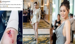 'Quỳnh Búp bê' gặp sự cố khi diễn cảnh hành động khiến nhiều người xót xa