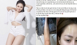 Hot girl Trâm Anh đáp trả cực gắt khi bị antifan dè bỉu đầu gối bị thâm