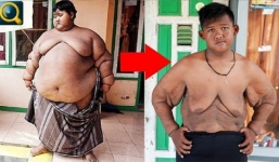 Ngoại hình hiện tại của cậu bé 11 tuổi nặng nhất hành tinh sau khi giảm được 216kg