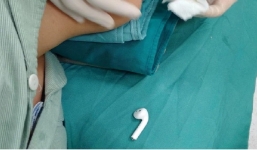 Hà Nội: Thiếu niên tự kỷ nuốt tai nghe không dây vào bụng khi đang sử dụng điện thoại