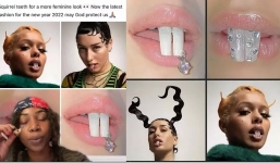 Độ răng bổ cào 'ăn đu đủ không cần thìa': Hot trend làm đẹp khiến nhiều người ngán ngẩm 